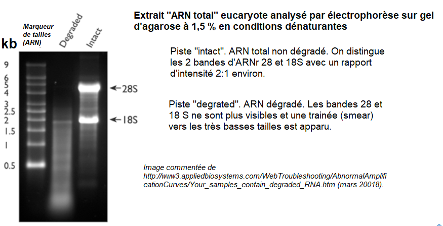 agarose arn total cns dénaturantes