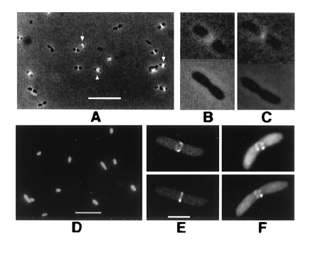 anneau de constriction, prot Ftsz, images microscopie